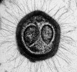 世界上最大的病毒 米米病毒直径800纳米（酷似细菌）